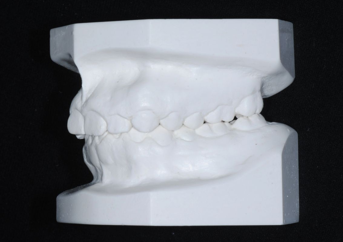 Tomografía CBCT 1