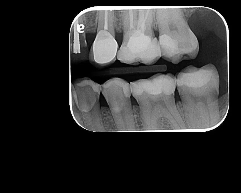 Intraoral 3