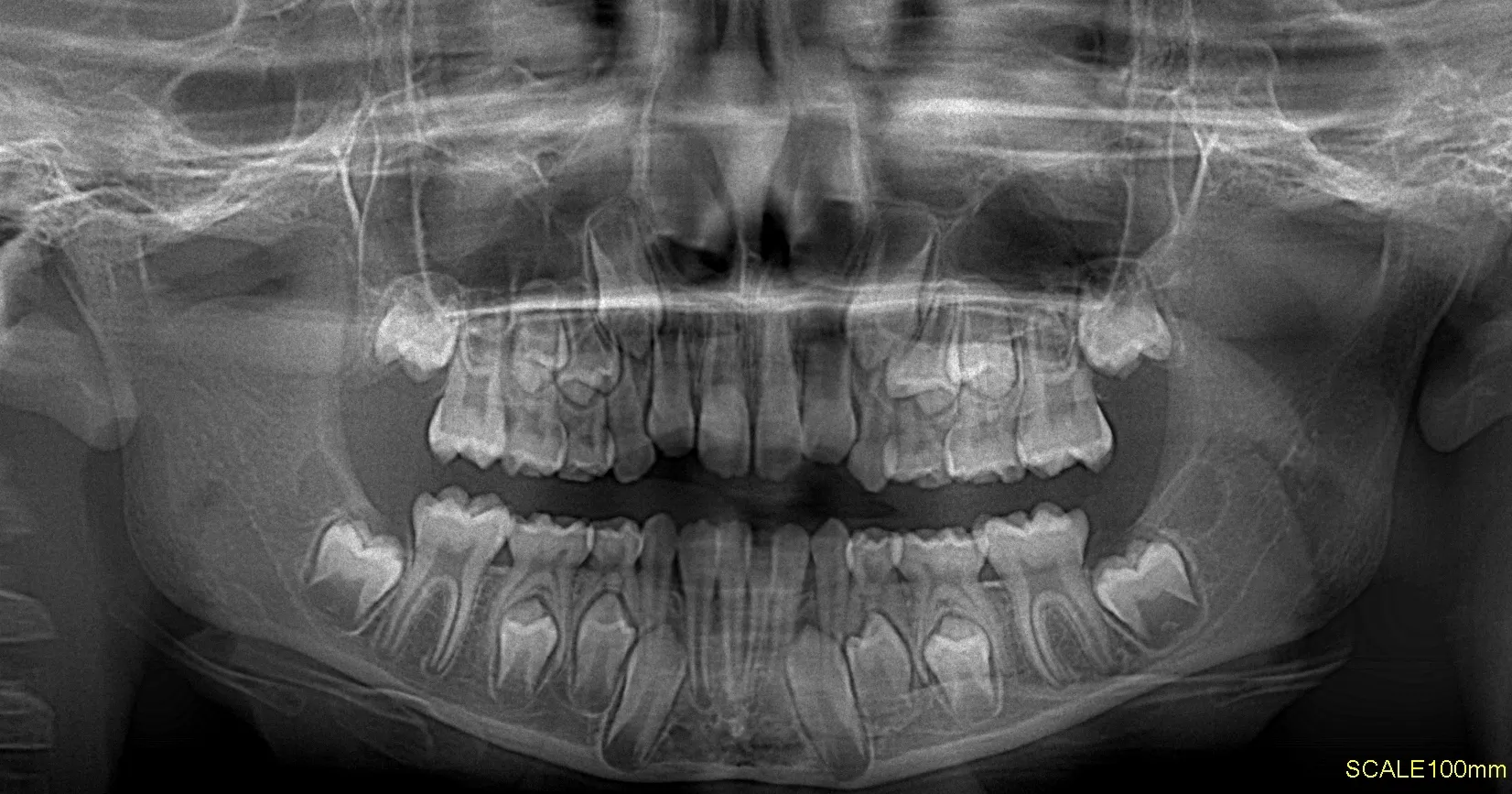 Tomografía CBCT 1