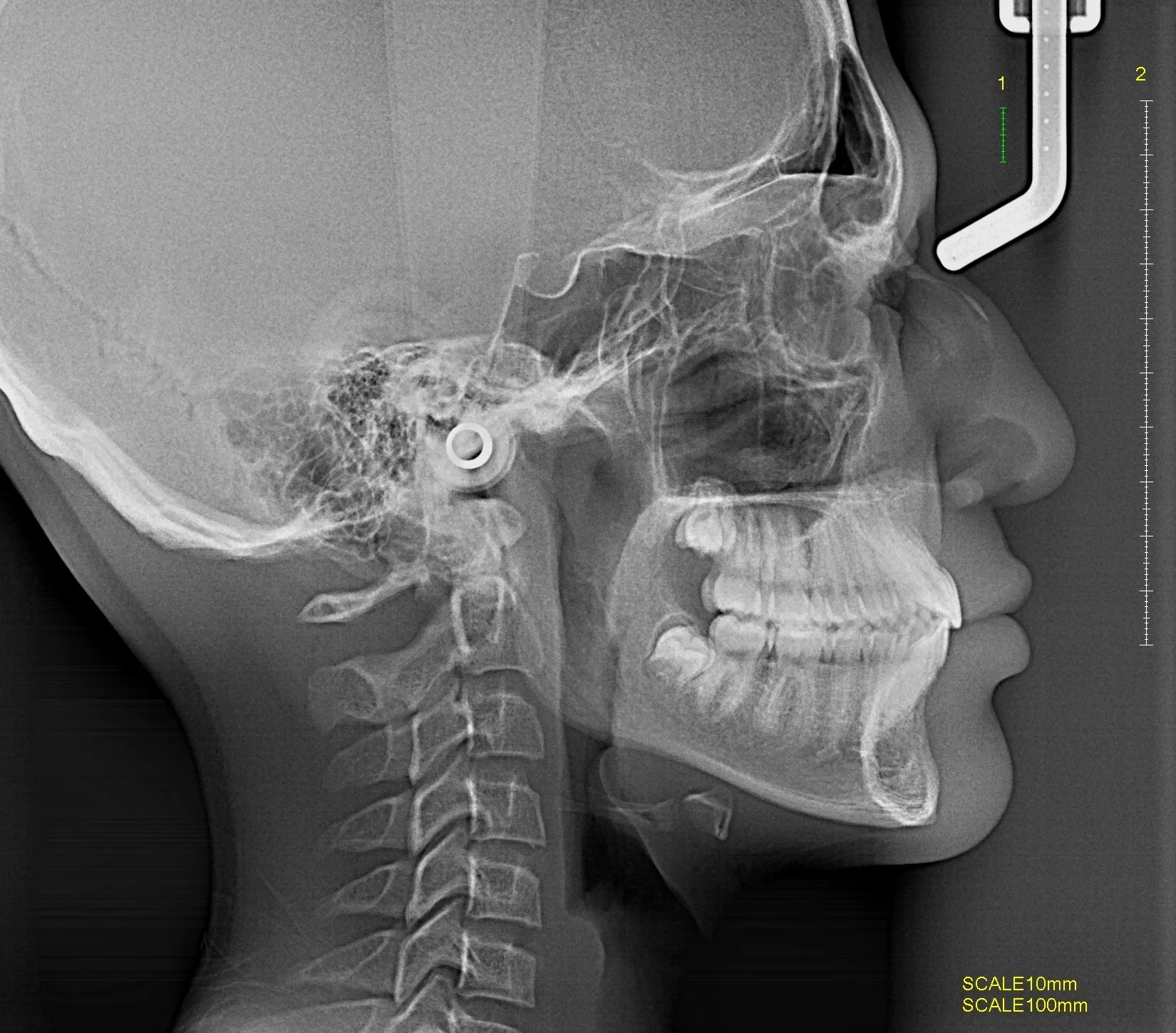 Tomografía CBCT 2