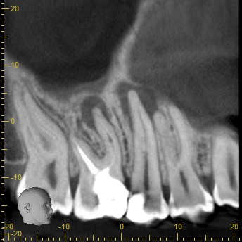 Tomografía CBCT 2