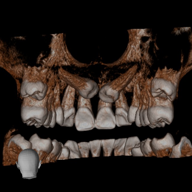 Tomografía CBCT 2